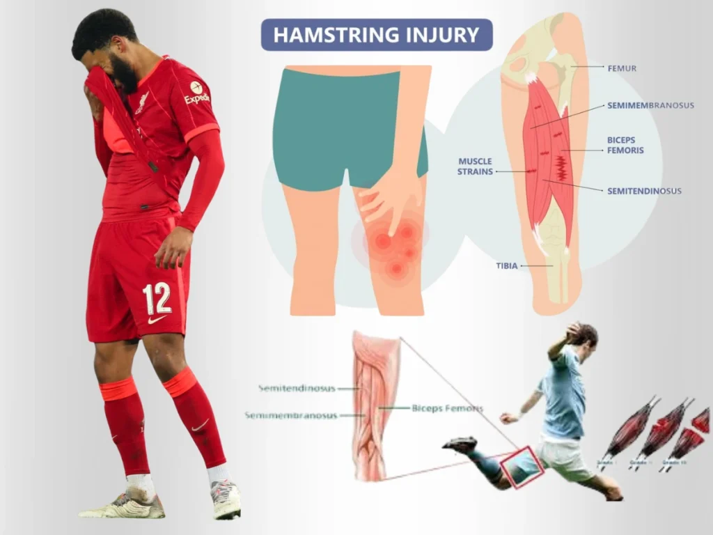 Liverpool Defender Joe Gomez and model of Hamstring injury on other side